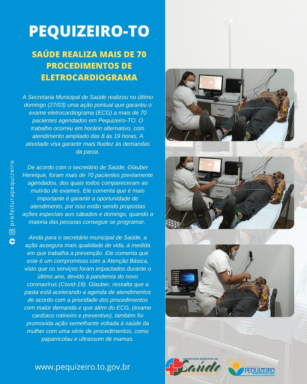 SECRETARIA MUNICIPAL DE SAÚDE REALIZA MAIS DE 70 PROCEDIMENTOS DE ELETROCARDIOGRAMA